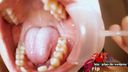 Amateur virgin Hina wisdom teeth & mouth opening appreciation of oral cavity with missing back of front teeth