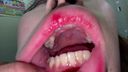 [This is already a vagina] Oral cavity that seems to eat Ji ● Port more than food Rear (2) KITR00274