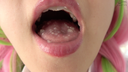 【Teeth / Mouth】Demon ● Blade Sweet ● Temple Honey (Tsugumi Mizusawa) Chan's teeth, mouth, throat observation & electric massage!!