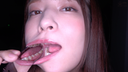 【Teeth / Mouth】Geki Kawa Actress Abe Mikako Chan's teeth and throat observation!