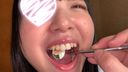 【Personal shooting】Observation of tooth extraction! Mirror check in the mouth of a neat and clean honor student Iris [Y-131]