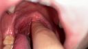 [個人拍攝]美月戲弄爬行動物臉的絞肉的喉嚨後部[Y-171]
