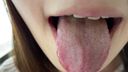 The tongue moss of a serious student is yellow AYANA KITR00291