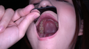 【Teeth / Mouth】Geki Kawa Actress Abe Mikako Chan's teeth and throat observation!