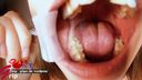 Amateur virgin Hina wisdom teeth & mouth opening appreciation of oral cavity with missing back of front teeth