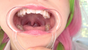 【Teeth / Mouth】Demon ● Blade Sweet ● Temple Honey (Tsugumi Mizusawa) Chan's teeth, mouth, throat observation & electric massage!!