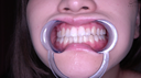 【牙齒】人氣女星陳美莉的牙齒觀察和附有嘴巴張開的電動手淫！！