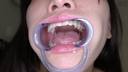 【Teeth and mouth】Popular actress Hoshi Ameri Chan's teeth & tongue bello mouth observation work