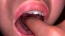 [個人拍攝]水澤津美的喉嚨責怪扁桃體腫脹[Y-244]