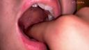 [個人拍攝]水澤津美的喉嚨責怪扁桃體腫脹[Y-244]