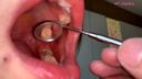 【個人拍攝】桐山悠的天然牙齒觀察和咬合力檢查！　【運-251】