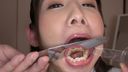 Dental Fetish Examination Record Mika Aikawa