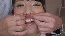 Dental Fetish Examination Record Mika Aikawa