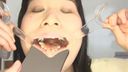 【Oral treatment】 Karte01 - Mizuki #1