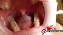 Amateur OL Erika is fascinated by close-up viewing of the oral cavity with wisdom teeth with a mouth opening