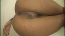 The [obscene video] that was leaked from cosmetic surgery is quite egregious ...　21