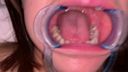 牙齒公主 7th [FBOM-00022]