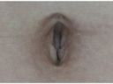 Navel of 100 amateurs 7