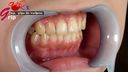 Amateur OL Erika is fascinated by close-up viewing of the oral cavity with wisdom teeth with a mouth opening