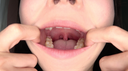 【嘴巴/牙齒】人氣女星花井雫陳極其罕見的牙齒、嘴巴、喉嚨觀察 ★