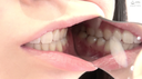 【Mouth / Teeth】Popular actress Hanai Shizuku Chan's extremely rare teeth, mouth, throat observation ★