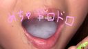 "Phimosis Ferramania #31" Gal Koto's 18-year-old true phimosis play