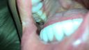 具合が悪くなったギャルの歯科検診をしました。 [KITR-00379]