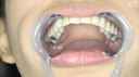 【Teeth / oral cavity】Popular actress Emily (Hikari Sakuraba) observed ★ Chan's teeth, spit, mouth, and throat dick