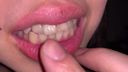 31st Tooth Princess [FBOM-00081]