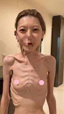 【閲覧注意】町田りな ガリガリ動画第十一弾 コロナワクチン副反応 ついに23kg。【拒食症】