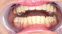 【Teeth / Mouth】Popular beautiful mature woman model Iroha Narimiya's teeth and mouth observation!