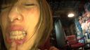 Immoral by a beautiful deli lady who is straightening her teeth [Teeth straightening girl]