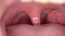 【Teeth / oral cavity】Popular actress Emily (Hikari Sakuraba) observed ★ Chan's teeth, spit, mouth, and throat dick