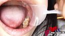 키리타니 미우의 은니와 사랑니와 공생하는 55mm 혀가 구강으로 열립니다