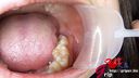 Wisdom tooth discovery that the pain of amateur clerk Yuka disappeared!? Mouth Aperture Oral Appreciation Tooth Brushing