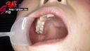 Wisdom tooth discovery that the pain of amateur clerk Yuka disappeared!? Mouth Aperture Oral Appreciation Tooth Brushing
