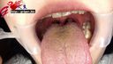 Amateur OL nako nako root black wisdom tooth!? Mouth Aperture Oral Appreciation & Tooth Brushing