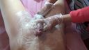 Brazilian Wax VIO Hair Removal Uncensored Video Vol.3 ★ The therapist was surprised by the ejaculation and the treatment was interrupted!