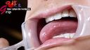 Dedicated Gal Himari's Whitened Beautiful Oral Cavity Aperture Close Up Appreciation