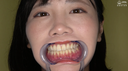 【Oral cavity】Popular model Kakuna Tsumugi Chan's super rare teeth, mouth, throat dick, spit observation!!