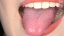 【Oral cavity】Popular model Kakuna Tsumugi Chan's super rare teeth, mouth, throat dick, spit observation!!
