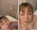 [Individual shooting] Smartphone shooting big gal removal When I noticed it, I was shooting on my face w [Amateur] High quality version present with review