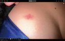 【완전 아마추어 리얼 동영상 #104】부끄러워하는 초부끄러워하는 소녀·남자친구의 키스 마크 위에 오지산 키스 마크를 넣어 보았다· #100% 리얼
