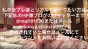 181 [Nipple hole expansion 14g→12g] Kawaei Rinani 19-year-old M woman 1