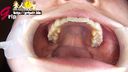 Female college student Aya's beautiful oral cavity without cavities appreciated with a mouth opening and tooth brushing