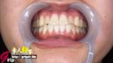 Female college student Aya's beautiful oral cavity without cavities appreciated with a mouth opening and tooth brushing