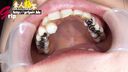 여대생의 기록적인 은색 치아 수에 감탄! 입 구멍으로 큰 수치심 구강 진단