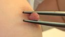 Nipple Health Checkup for Schoolgirls 3