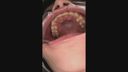 Kagura Aine 20 Teeth &amp; Mouth Closeup! Pulp Pull's throat &amp; tooth decay discovery ... It's more erotic in the mouth than the genitals!
