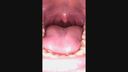 카구라 아이네 20 이빨 &amp; 입 근접 촬영! 펄프 풀의 목구멍 및 충치 발견 ... 성기보다 입안이 에로틱하다!